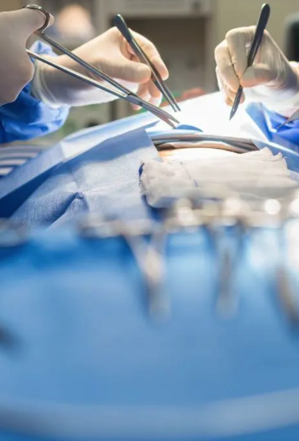 microcirurgia de varizes